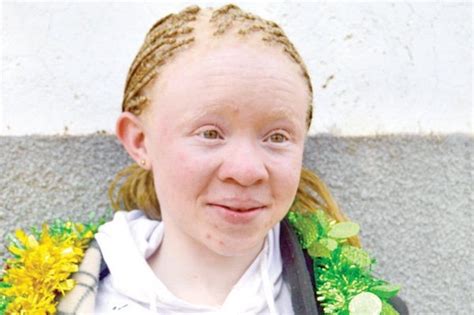 Albino Girl And Gets Facial Girls Flashing Threesome