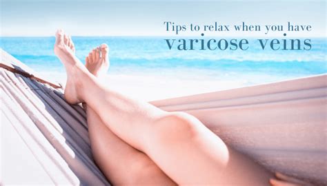 Tips To Relax When You Have Varicose Veins Dr Abhilash Sandhyala
