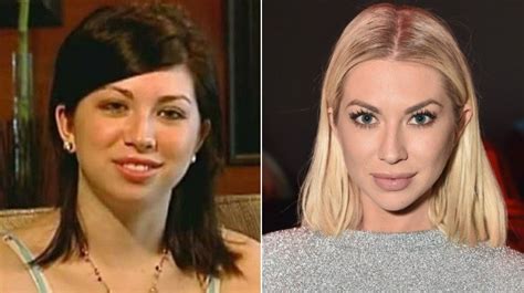 Reality Stars Before And After Plastic Surgery Looks
