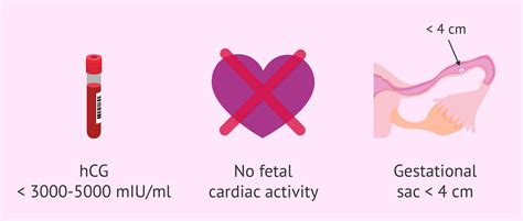 medical treatment  ectopic pregnancy