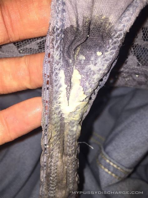creamy vaginal discharge on panties my pussy discharge