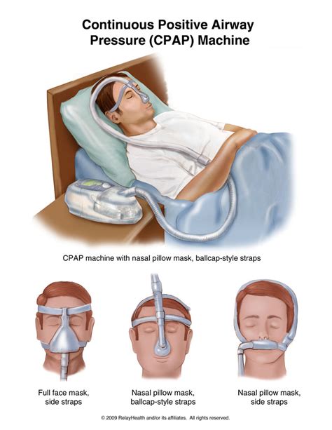 sleep apnea cpap machine