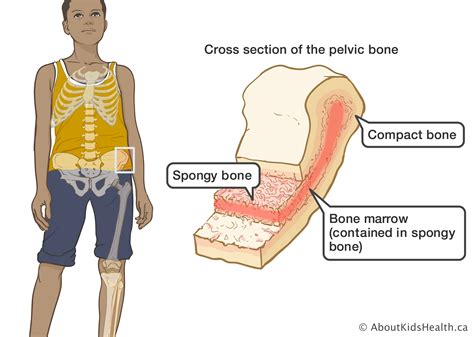 bone marrow tests  cancer diagnosis