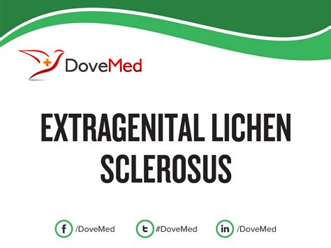 extragenital lichen sclerosus