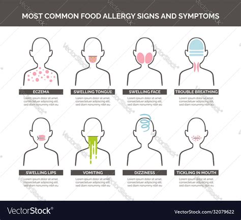 food allergy signs  symptoms royalty  vector image