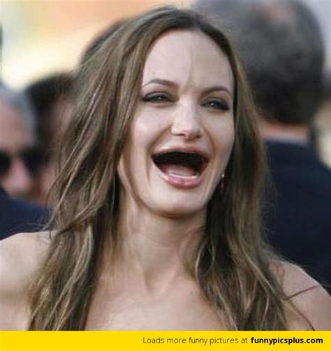 20 Best Celebrity Without Teeth Funny Pictures