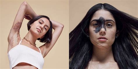 missguided s new body positive campaign also celebrates skin