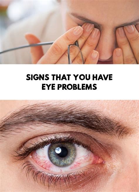 signs    eye problems eyes problems dry eye syndrome