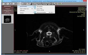 RadiAnt DICOM Viewer screenshot #6