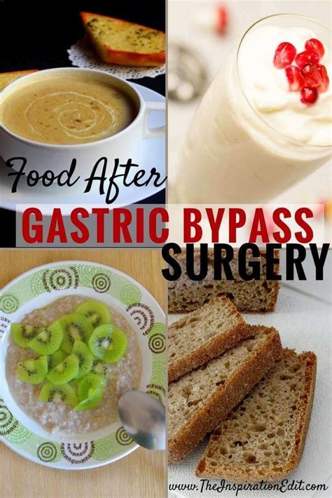 What To Eat After Gastric Bypass Surgery Gastric Bypass Surgery