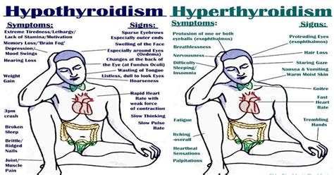 hypo vs hyperthyroidism all the signs symptoms triggers and