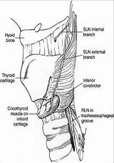 Laryngeal Recurrent Nerves Rln Thyroid Parathyroid Randolph Glands Sln sketch template