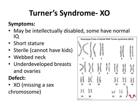 Ppt Karyotype And Chromosomal Mutation Notes Powerpoint Presentation