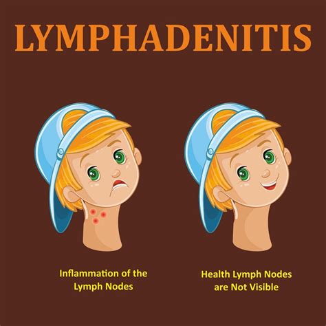 child  enlarged lymph nodes  lymphadenitis dr ankit