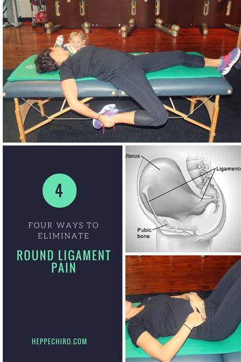 4 Ways To Eliminate Round Ligament Pain — Drs Heppe