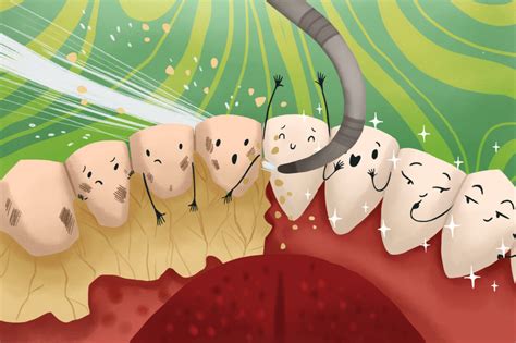 how to prevent plaque buildup ballston dental care in arlington
