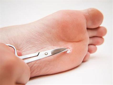 what are the benefits of nursing foot care ctg blog