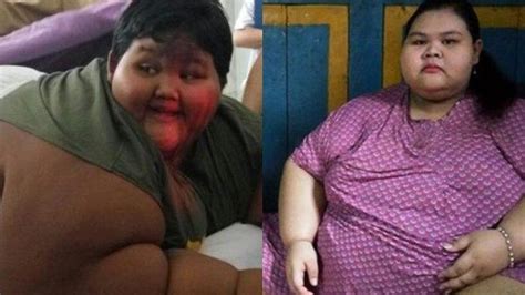 tak hanya arya permana gadis belia asal lamongan silvia dwi susanti juga alami obesitas