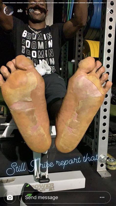 Antonio Brown Burned His Feet In Cryotherapy Machine Blacksportsonline