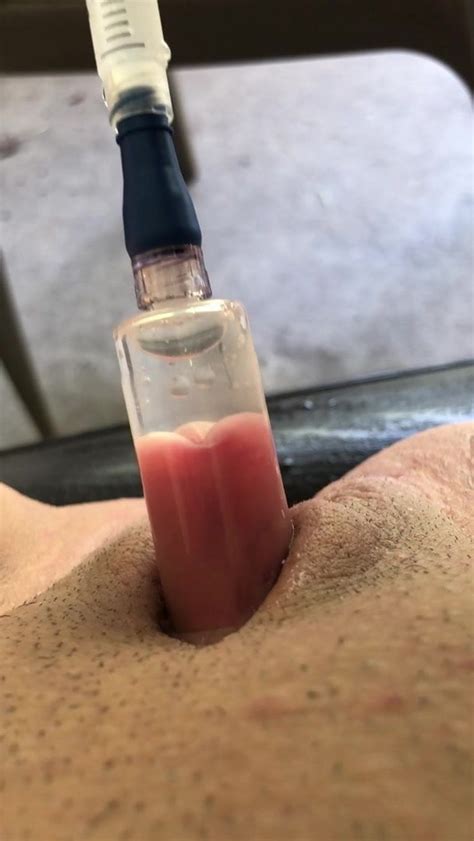 Homemade Clit Pump And Pussy Cum Free Mobile Tube Xxx Hd Porn