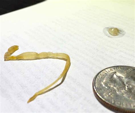 id for whipworms strongyloides or hookworm clean pics at parasites support forum alt med