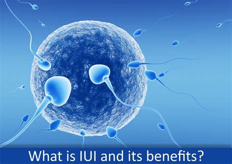 intrauterine insemination iui and its benefits health blog