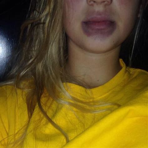 teens are sucking on bottles to get lap chiong lips just like kylie s