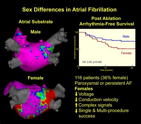 Sex Related Differences In Atrial Remodeling In Patients With Atrial