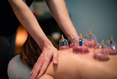 cupping therapy — body and soul massage therapy