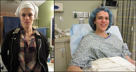 I Had Facial Feminization Surgery Autostraddle
