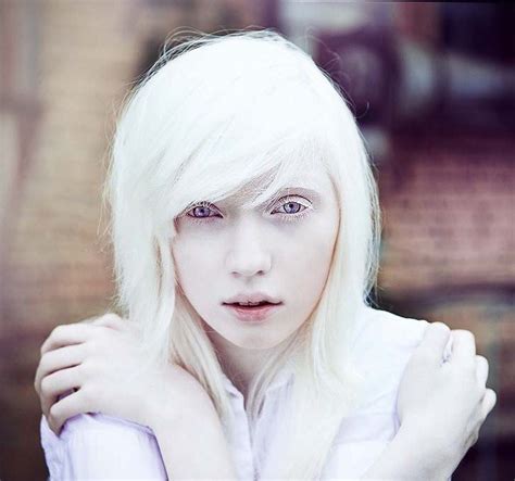 The Most Beautiful Albino Girl In World Bukge Albino