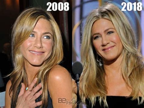 Jennifer Aniston Plastic Surgery Before And After Photos
