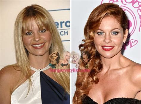 Candace Cameron Plastic Surgery The Truth About The