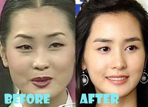 lee da hae plastic surgery before and after pictures lovely surgery