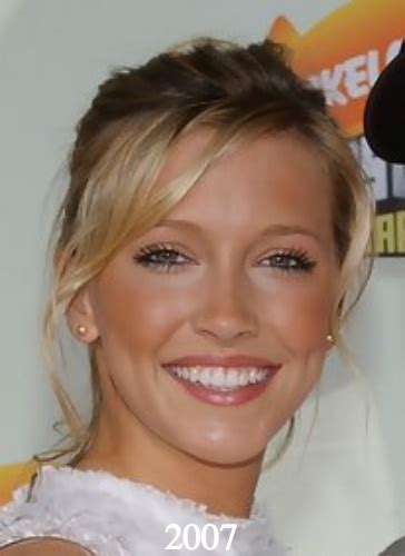 katie cassidy plastic surgery before and after photos