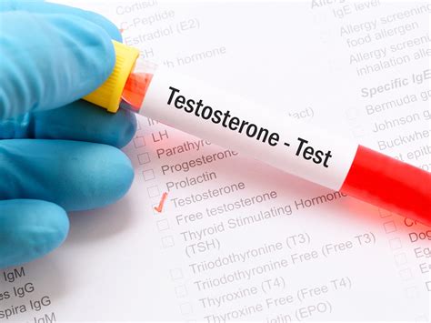 how much do testosterone levels really matter easy health options®