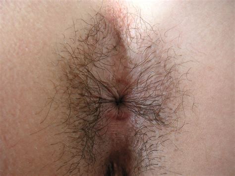 Hairy Pussy And Asshole Up Close Image 4 Fap