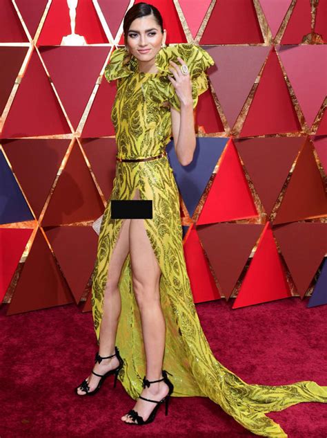 Oscars 2018 Most Embarrassing Wardrobe Malfunctions At Academy Awards