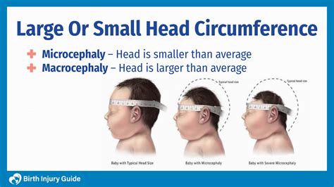 large  small head circumference birth injury guide