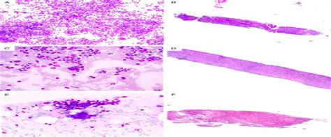 Pd 1 And Pd L1 Immunohistochemistry As A Diagnostic Tool For The