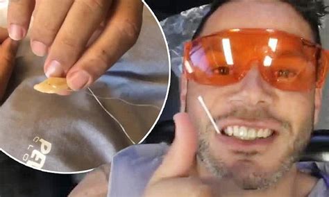 mafs telv williams documents his infected tooth extraction daily mail online