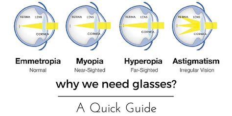 astigmatism short sightedness hypnotherapy to lose weight