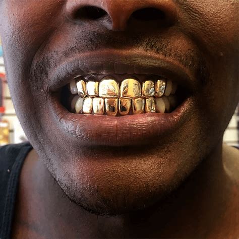 gold classic solid set buy gold teeth
