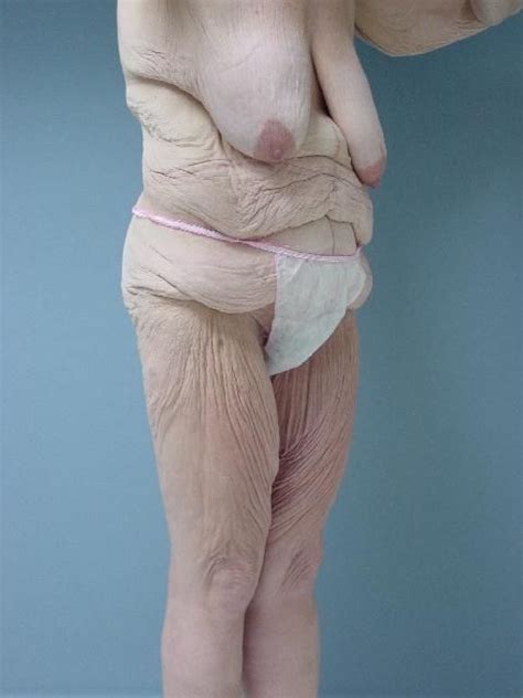 old wrinkly saggy granny body