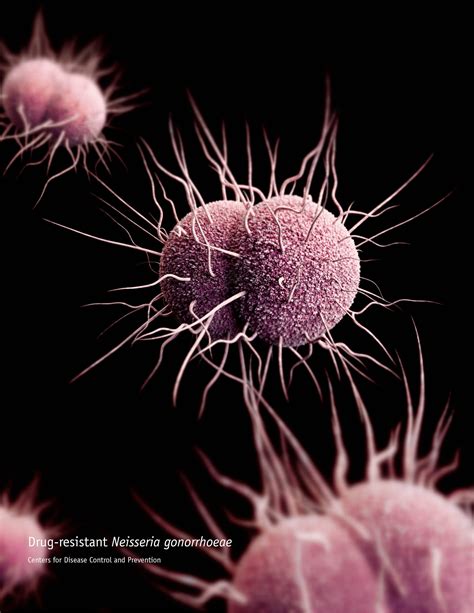 Gonorrhea Resistance To Azm Reaches 5 Threshold Among Seattle Msm