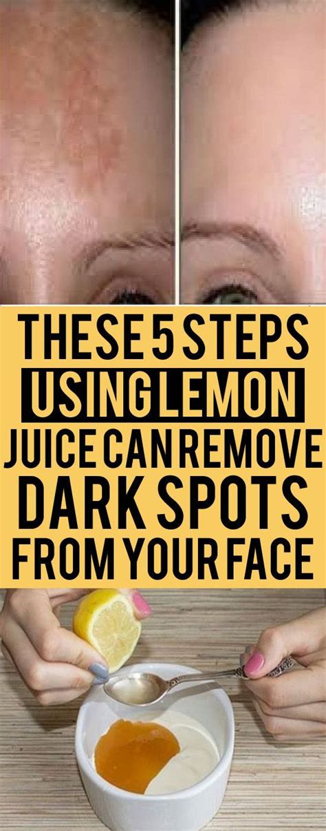 how to lighten skin with lemon resipes my familly