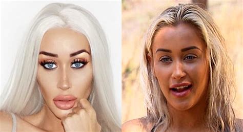 why do people want to look like blow up dolls so badly r