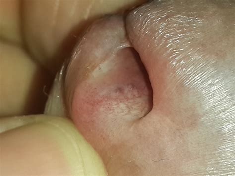 penis inside male urethra mega porn pics