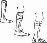 Brace Leg Clip Braces Plastic Clipground Hesperian School sketch template