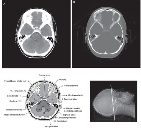 anatomy  ct scan brain background
